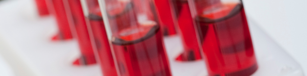 deficiency zinc blood test Analysis  MicroTrace Minerals Metal Blood