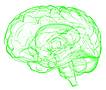 Menschliches Gehirn - Alzheimer